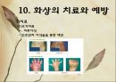 화상 (BURNS) - 화상의 발생빈도 원인 위험요인 진단 종류 36페이지