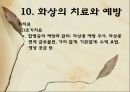 화상 (BURNS) - 화상의 발생빈도 원인 위험요인 진단 종류 38페이지