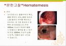 A+위출혈hematemesis case위출혈케이스 6페이지