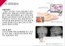 A+다발성 골수종Case conference 9페이지