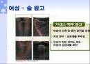광고 속 성 상품화 11페이지