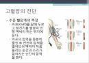 고혈압 진단 및 치료법 고혈압 질환 교육 12페이지