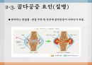 노인의 골다공증골다공증 현황과 문제점골다공증 정의골다공증 원인 요인 및 분류골다공증 증상과 합병증골다공증 진단골다공증 예방과 관리골다공증을 위한 대책 15페이지