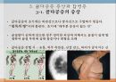 노인의 골다공증골다공증 현황과 문제점골다공증 정의골다공증 원인 요인 및 분류골다공증 증상과 합병증골다공증 진단골다공증 예방과 관리골다공증을 위한 대책 18페이지
