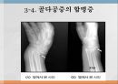노인의 골다공증골다공증 현황과 문제점골다공증 정의골다공증 원인 요인 및 분류골다공증 증상과 합병증골다공증 진단골다공증 예방과 관리골다공증을 위한 대책 24페이지
