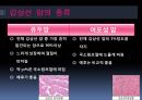 갑상선암갑상선의 구조암의 정의갑상선 암의 원인갑상선의 기능 5페이지