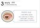 감각기계질환노인성난청백내장녹내장 11페이지