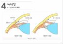 감각기계질환노인성난청백내장녹내장 15페이지