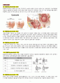 Cystocele(방광류 방광탈출) 여성건강간호학 A+ Case Study 자료 2페이지