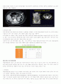 Ulcerative Colitis(궤양성대장염) 성인간호학 A+ Case Study 자료 5페이지