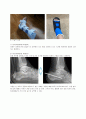 성인간호 외과계case stucy (골절) 9페이지