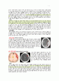 성인실습 특수파트 외상계중환자실 TICU SDH 지주막하출혈 6페이지