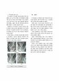 Hand therapy와 Machine therapy를 이용한 Scalp massage 효과의 비교 연구 7페이지