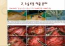 로봇 로봇수술의역사 수술로봇적용분야 로봇수술과공학의관련성 로봇수술의한계및발전 13페이지