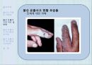 불산유출사고,재난위기관리,불산의개념,불산의위험성,불산유출사고위기관리개선방안 7페이지