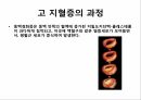 고지혈증 피피티 발표자료 5페이지