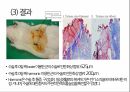 a+++ 수술간호 ppt 편도절제술 1. 편도란? 2. 적응증 3. 검사/시술/수술 방법 4. 준비사항 5. 경과 및 합병증 6. 수술 전 간호 7. 수술 후 간호 8. 참고문헌 9. 느낀점 9페이지