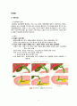 담관염 케이스, 담관염 CASE, 간호진단 3개, A+ 자료입니다 4페이지