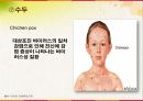 학교보건간호 실습 전염병과제 15페이지
