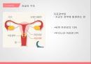 백신과자궁질환,자궁경부암,자궁근종,자궁내막증 4페이지