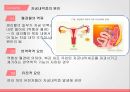 백신과자궁질환,자궁경부암,자궁근종,자궁내막증 15페이지