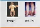 수용성비타민,비타민의정의,티아민,리보플라빈,니아신,판토텐산,비오틴,엽산,비타민C 16페이지