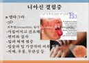 수용성비타민,비타민의정의,티아민,리보플라빈,니아신,판토텐산,비오틴,엽산,비타민C 36페이지