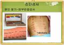 알레르기 보건교육 14페이지