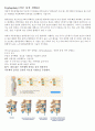 Kyphoplasty(경피적 풍선 척추 성형술) 1페이지