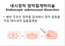 대장암의 진단 & 수술적 치료종류 8페이지