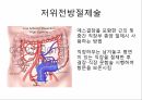 대장암의 진단 & 수술적 치료종류 10페이지