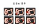 대장암의 진단 & 수술적 치료종류 16페이지