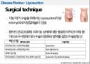 Liposuction(지방흡인술) 성형외과 NEJM 저널리뷰 7장 포함 일부대본 5페이지