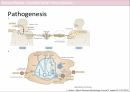 VZV_Varicella zoster virus infection_소아청소년과_감염내과_발표자료 6페이지