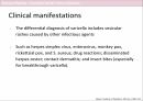 VZV_Varicella zoster virus infection_소아청소년과_감염내과_발표자료 8페이지