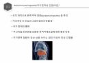 (발표 PPT) 자가면역성 간염(Autoimmune hepatitis)에 관하여 5페이지