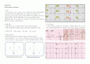 성인간호학 - 과제 심근경색(myocardiac infarction) 1페이지