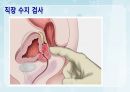 성인간호학(비뇨생식기계질환,은하출판사) 69페이지