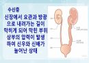 성인간호학(비뇨생식기계질환,은하출판사) 90페이지