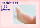 성인간호학(피부계질환,은하출판사) 17페이지