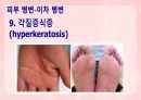 성인간호학(피부계질환,은하출판사) 25페이지