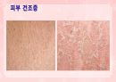 성인간호학(피부계질환,은하출판사) 26페이지