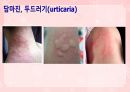 성인간호학(피부계질환,은하출판사) 39페이지
