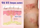 성인간호학(피부계질환,은하출판사) 50페이지