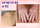 성인간호학(피부계질환,은하출판사) 62페이지
