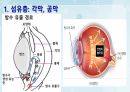 성인간호학(안과질환,은하출판사) 7페이지