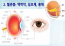성인간호학(안과질환,은하출판사) 8페이지