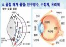성인간호학(안과질환,은하출판사) 10페이지
