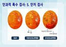 성인간호학(안과질환,은하출판사) 15페이지