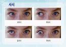 성인간호학(안과질환,은하출판사) 20페이지